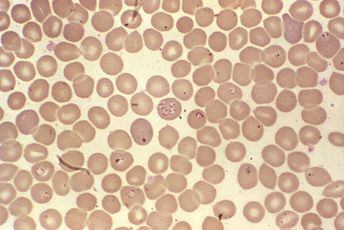 Babesia