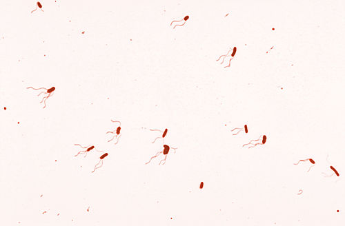 Bordetella