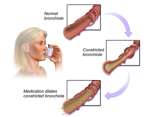 Bronchodilator