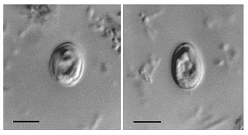 Cryptosporidium