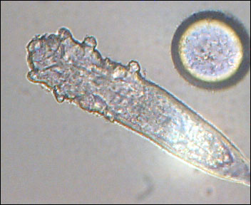 Demodex