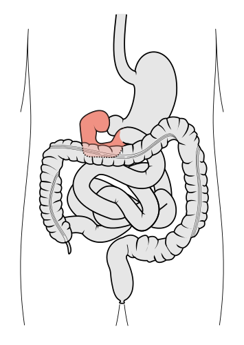 Duodenum