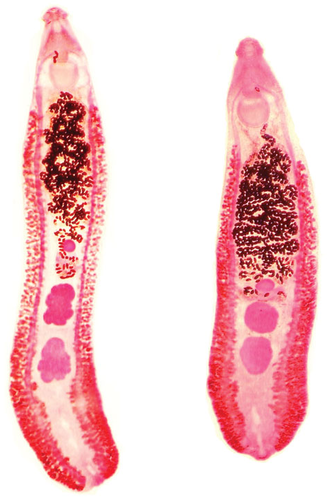 Echinostoma