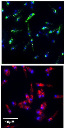 Leishmaniavirus