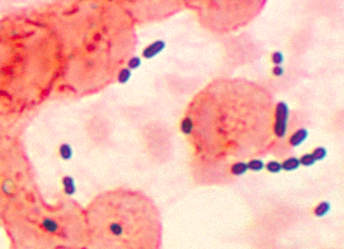 enterococcus