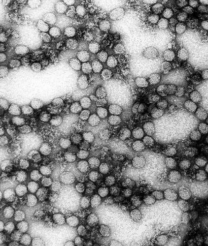 flavivirus