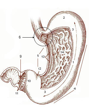 gastrectomy