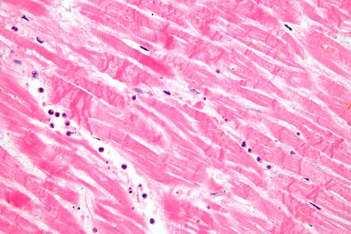 histopathology