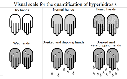 hyperhidrosis