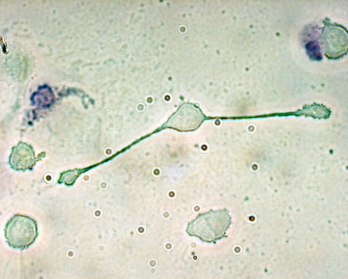 macrophage