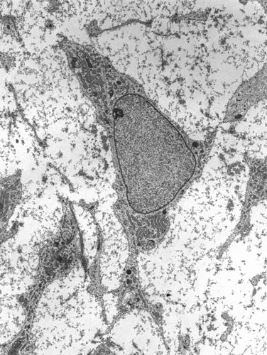 mesenchyme