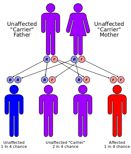 mucopolysaccharidosis