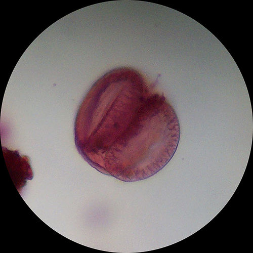 palynology