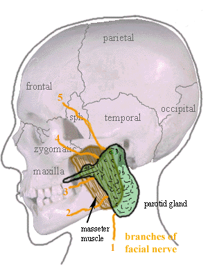 parotidectomy