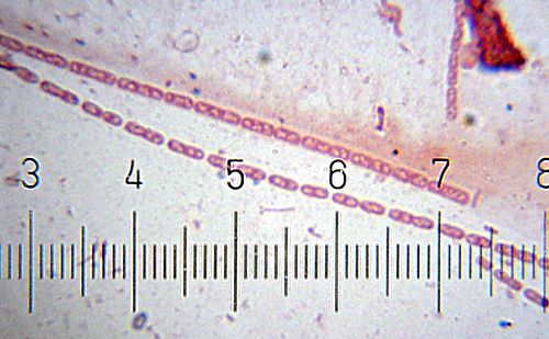 streptobacillus