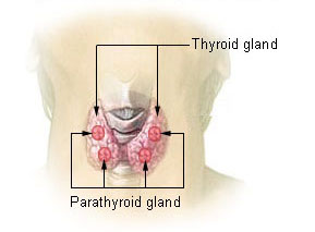 thyroiditis