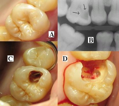 Learn How To Start dental implant center in Dwarka